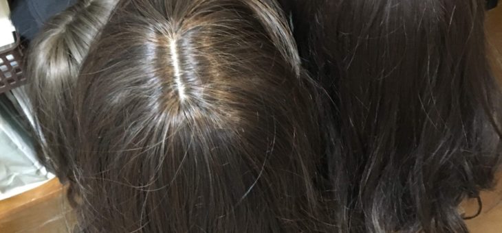 髪が抜けてきたら…④ウィッグ